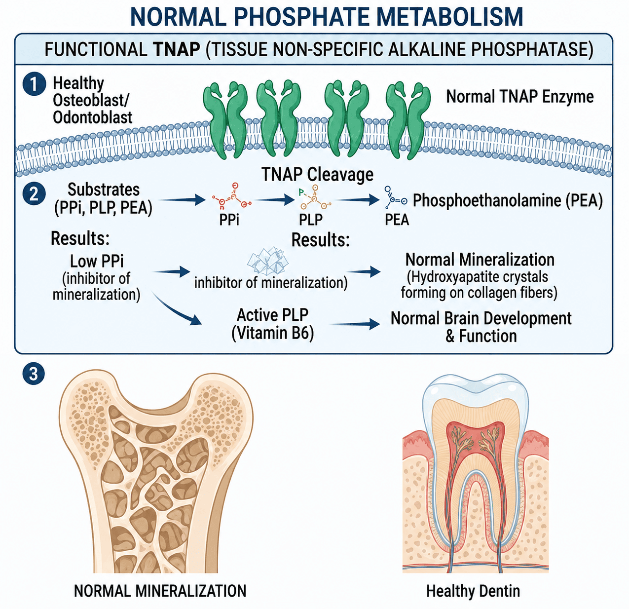 Hypophosphatasia image